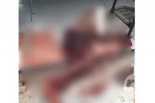 Jovem leva 10 tiros em menos de 15 dias e sobrevive a dois atentados
