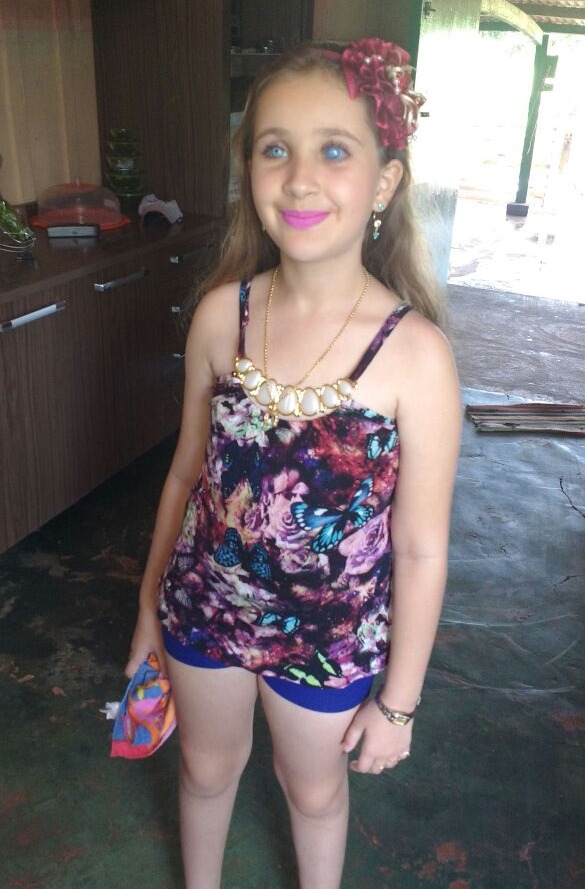 Família e amigos realizarão ‘Bingo e Leilão Beneficente’ para ajudar menina que precisa de prótese para olho 