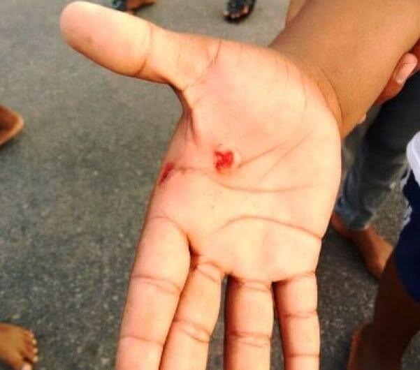 Durante jogo do Brasil, mulher que estava lavando roupas é atingida por bala perdida em Dourados