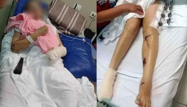 Ciclista que teve dedos amputados depois de ser atropelada por ônibus deixa a UTI