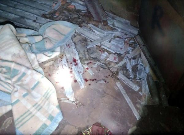 Jovem atacado com pedaço de meio-fio fica desfigurado