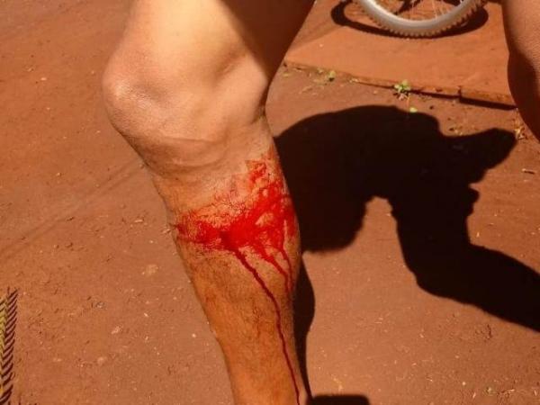 Em 20 dias, índios denunciam 2º ataque de seguranças a acampamento