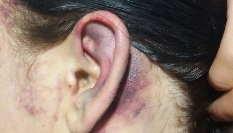 Ex pula muro e jovem é mantida refém em sessão de espancamento e tortura