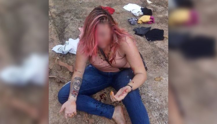 Homem agride ex-mulher, tira fotos e ameaça postar em rede social