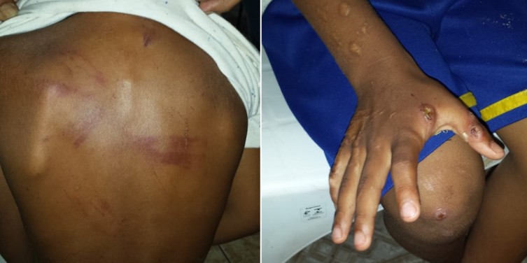 Mãe presa por tortura diz que agrediu menino ao vê-lo sofrendo tentativa de estupro