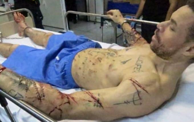 Para receber medicamentos, ele precisou ser amarrado em uma maca. (Foto: Reprodução)