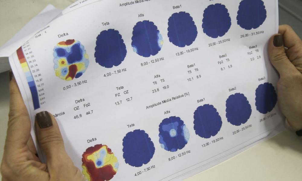 Campanha é promovida pela Associação Brasileira de Epilepsia; Foto: Agência Brasil