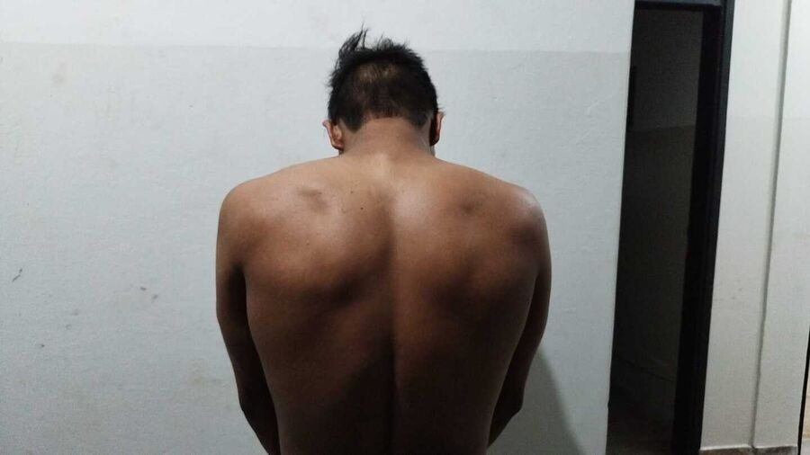 Morte de mulher com lesão na perna foi motivada por ciúme e a mando da irmã