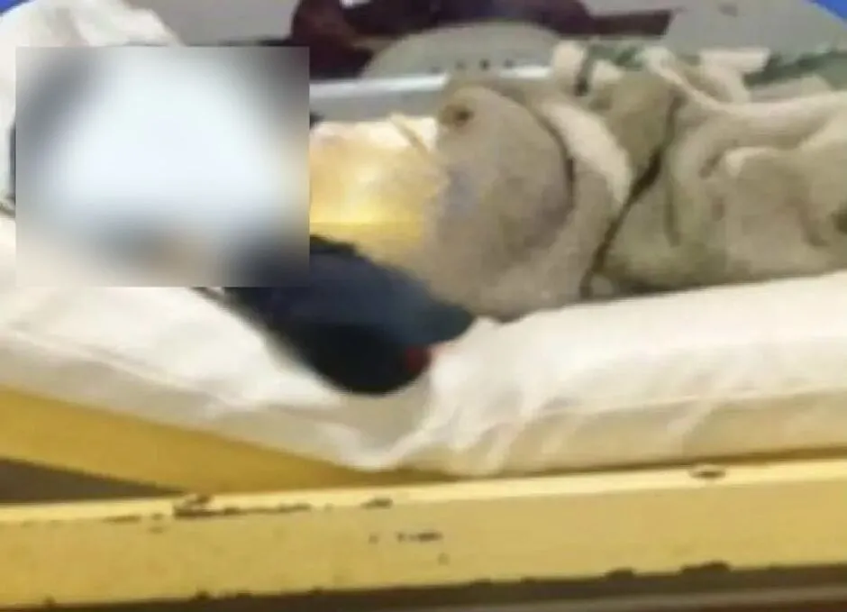 Menino está hospitalizado no Hospital Regional Pedro Juan Caballero / Reprodução/Urundey FM 