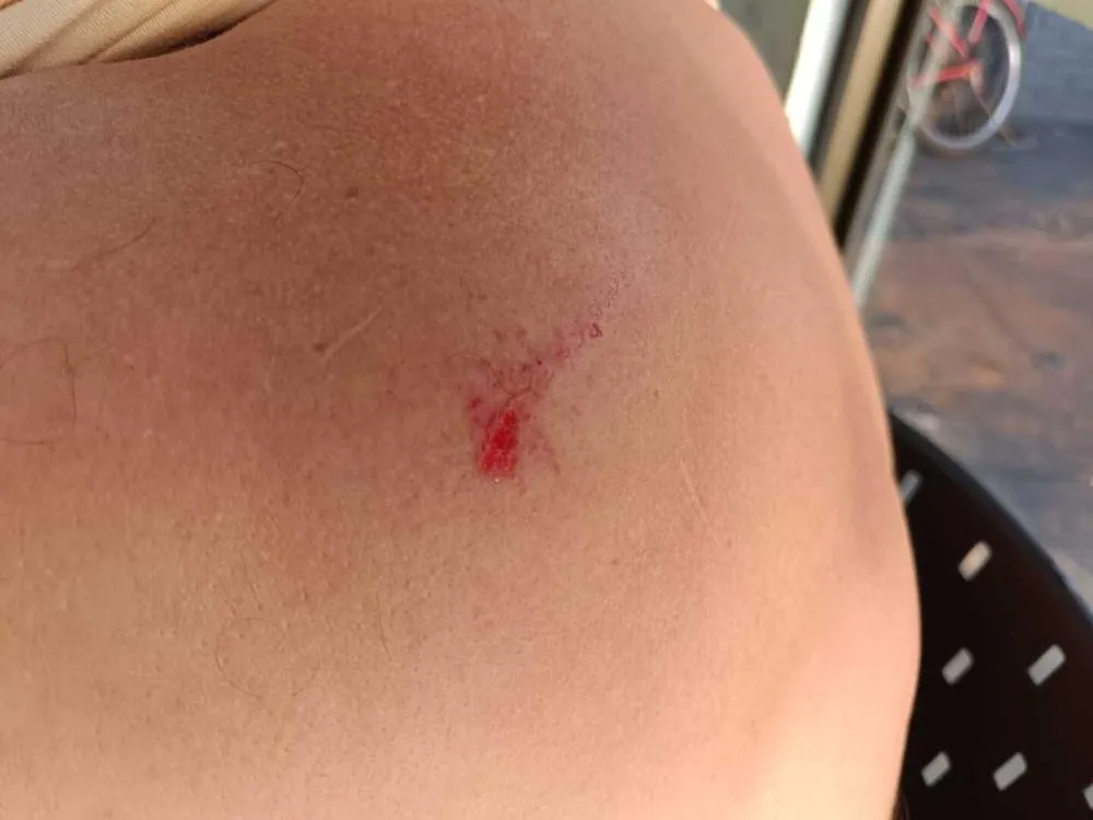 Filho é preso após agredir com tijolo o pai que tentava separar briga entre irmãos