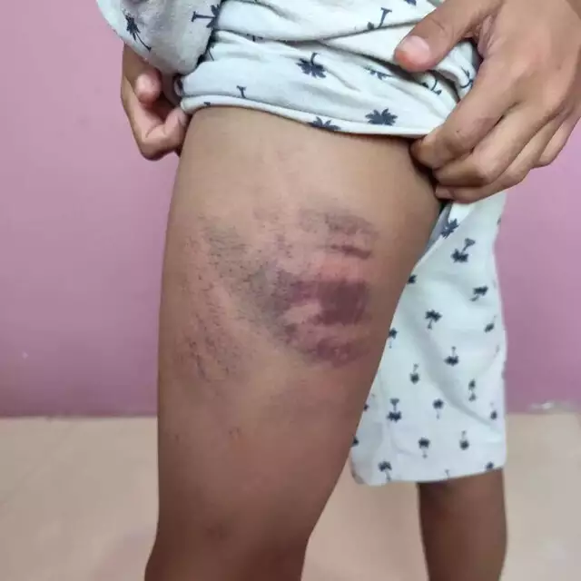 Menino autista é agredido por colega e pais na saída de aula