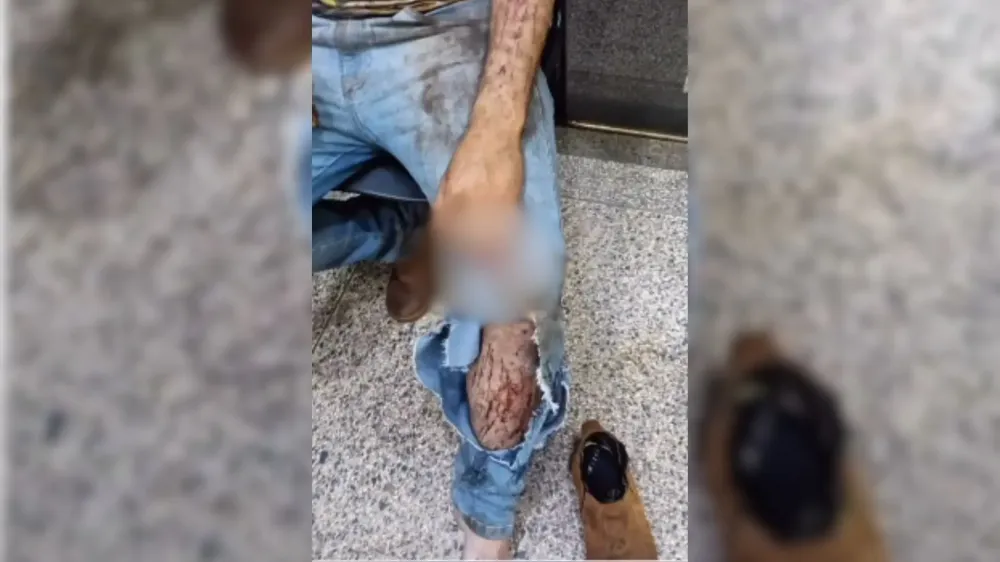 Trabalhador é atacado por onça durante colheita em Ponta Porã